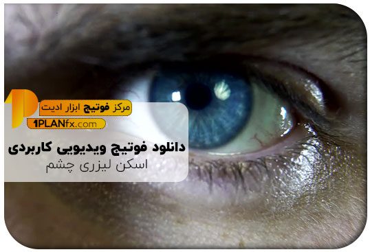 پیش نمایش فوتیج ویدیویی کاربردی اسکن لیزری بیومتریک چشم